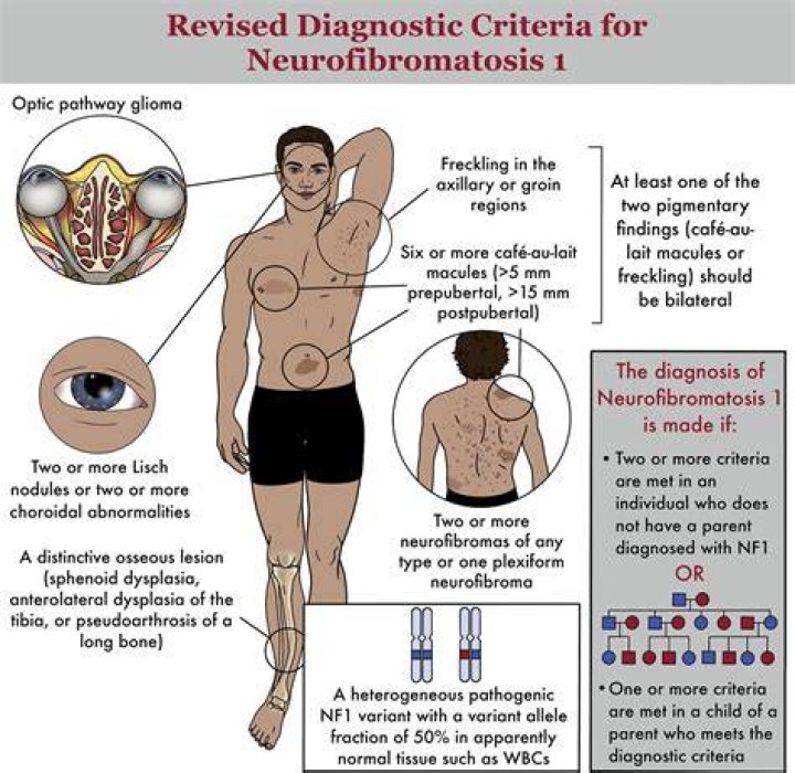 Can a blood test detect neurofibromatosis?