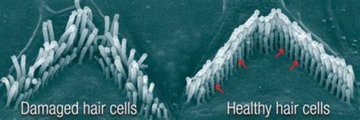 Can damaged hair cells be repaired?