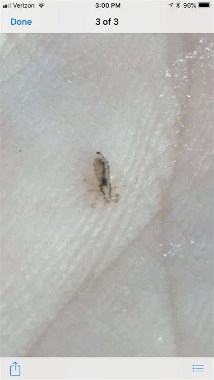 Can u get lice from a pillow?