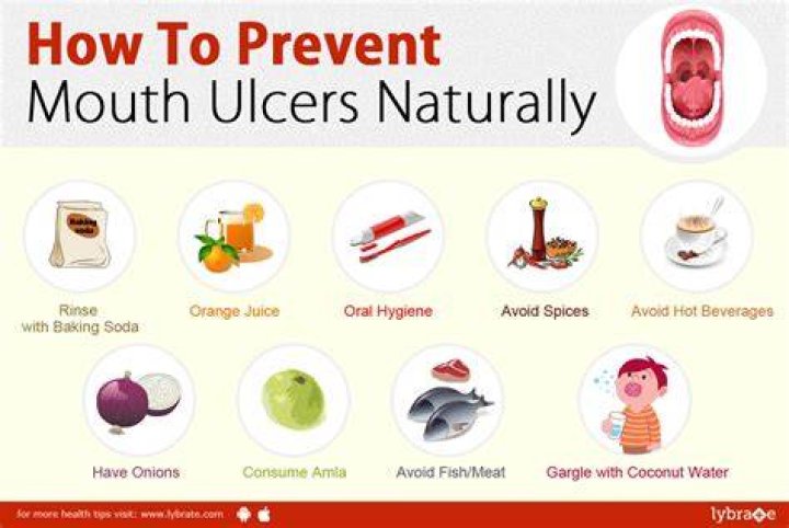 Is lemon good for mouth ulcer?