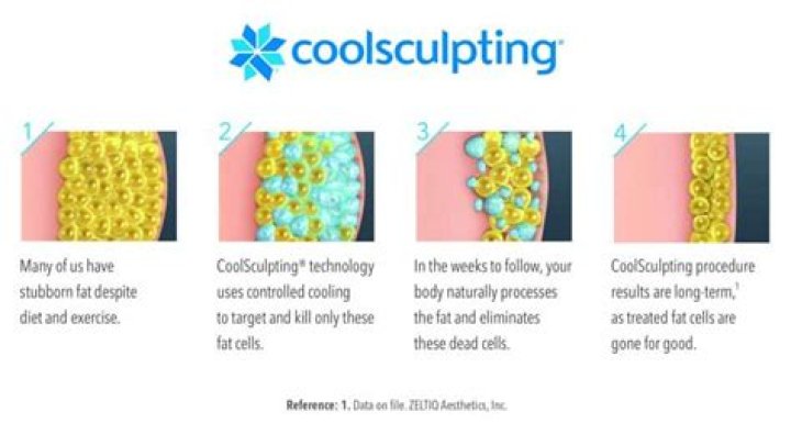 What are the dangers of CoolSculpting?